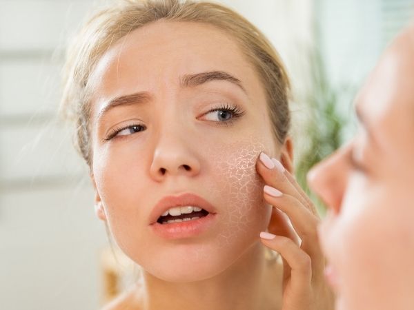 How to Treat Dehydrated Skin