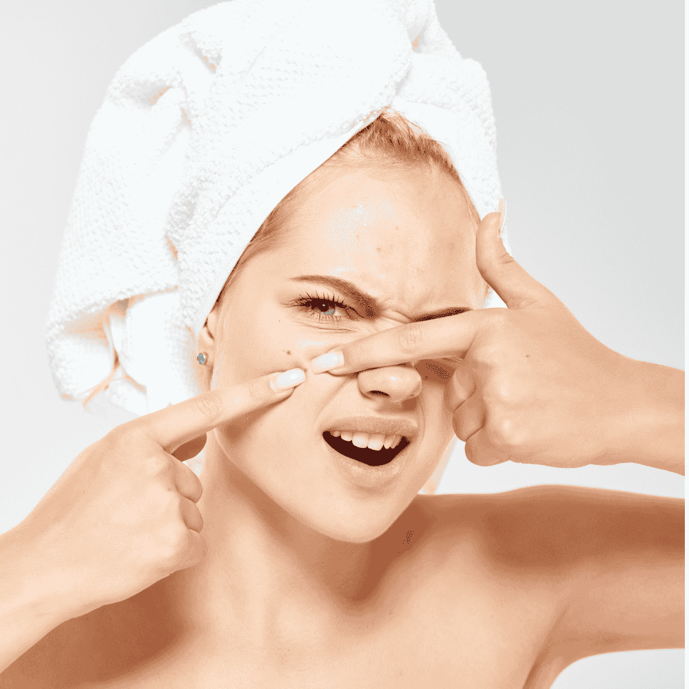 Natural Face Masks for Acne and Blackheads